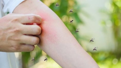 Invasión de mosquitos: cinco trucos eficaces que desconocías para ahuyentarlos (Imagen ilustrativa / Web)