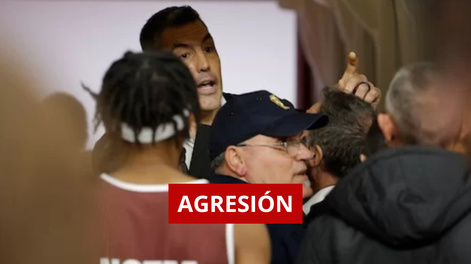 Luis Scola fue agredido en Italia.