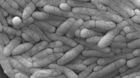 La bacteria Salmonella Typhi hallada en los estudios de laboratorio.